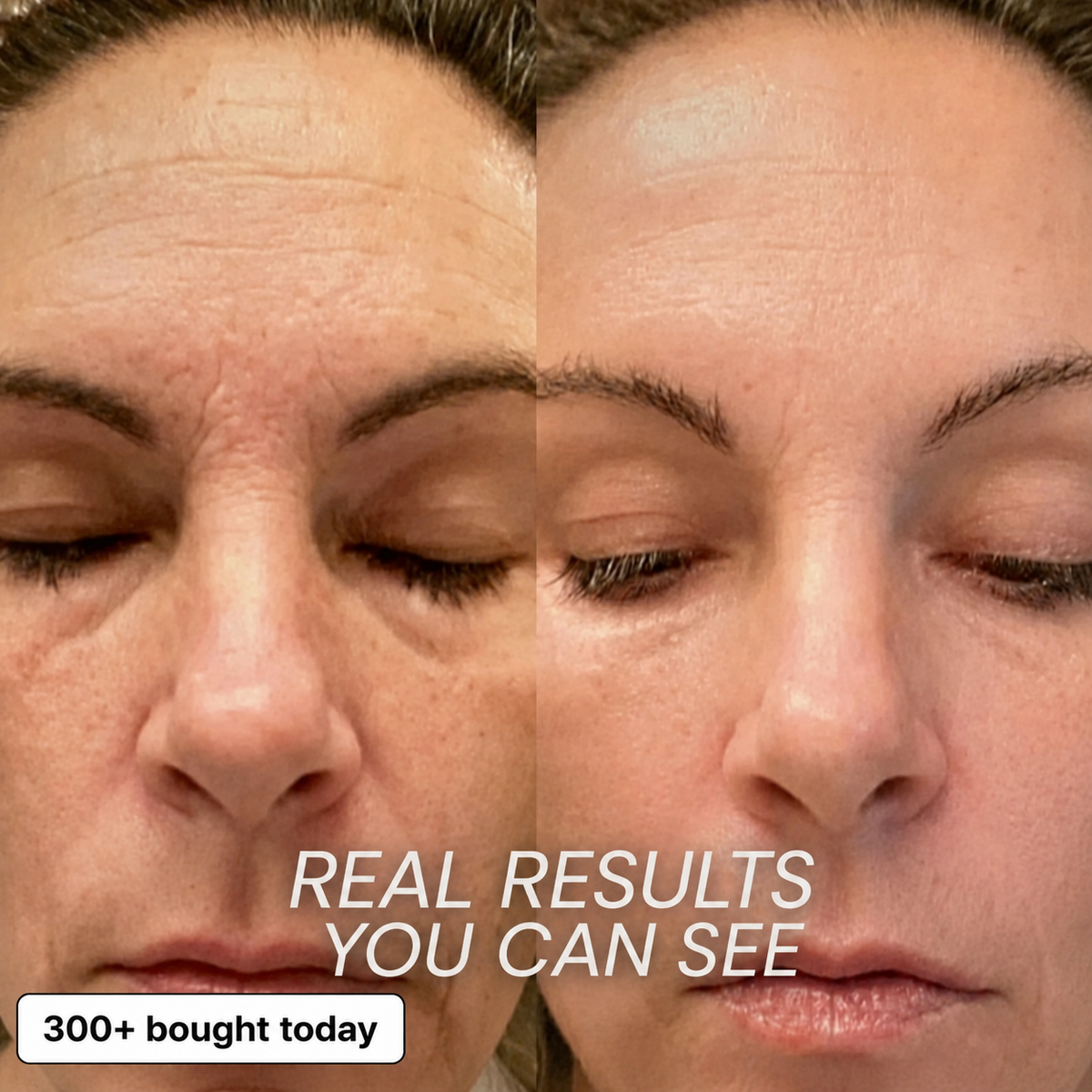 Bio-Collagen & PDRN Plumping Stick