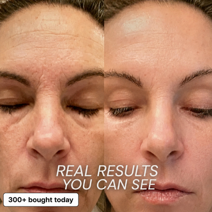 Bio-Collagen & PDRN Plumping Stick