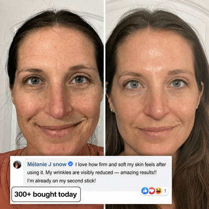 Bio-Collagen & PDRN Plumping Stick